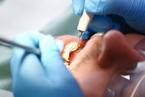 Best Walk-In Emergency Dentist in Cameron, TX